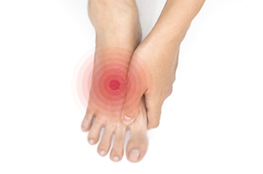 Serious Foot Wounds May Not Cause Pain in Diabetes